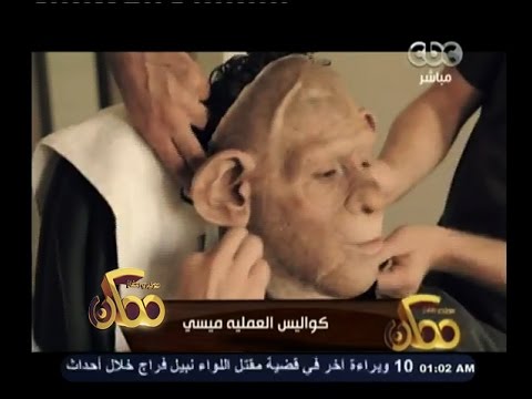 تجهيز القرد مسعد في العملية ميسي