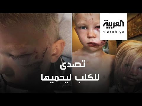 شاهد  طفل بريطاني يواجه كلبًا ضالًا دفاعًا عن شقيقته